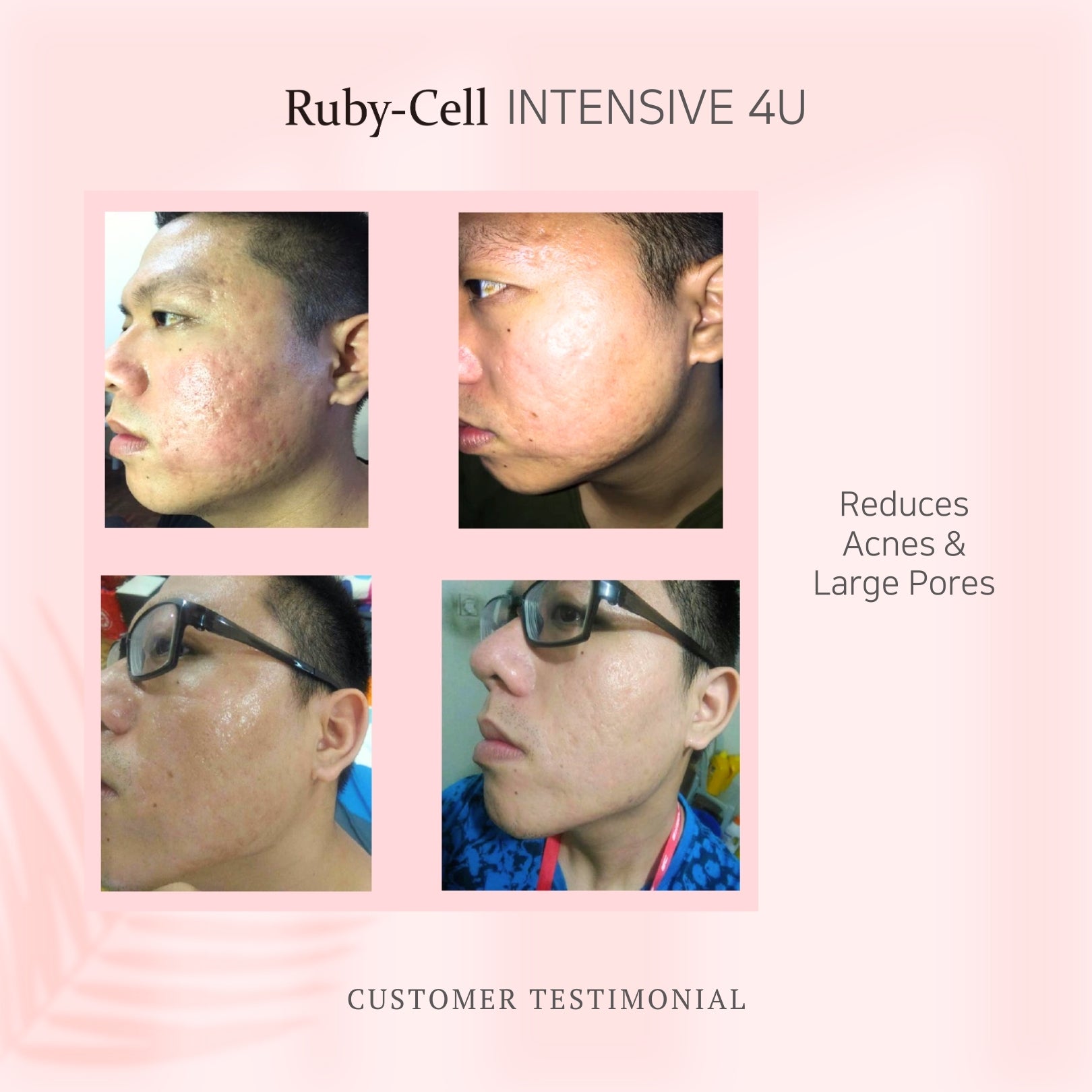 Ruby-Cell Intensive 4U – Ruby-Cell Malaysia